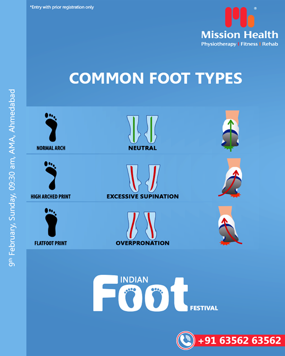 Look l Check l Click l Share

In simple four steps, get your registration done for the Indian FOOT Festival.

Learn all about FOOT abnormalities, causes, and their solutions. Visit us at the Indian FOOT Festival by Mission Health

Keep Reading this space for more updates!

Call: +916356263562
Visit: www.missionhealth.co.in

#IndianFootFestival #ComingSoon #FootClinic #footpain #footcare #foothealth #heelpain #anklepain #flatfeet #painrelief #healthyfeet #happyfeet #MissionHealth #MissionHealthIndia #MovementIsLife