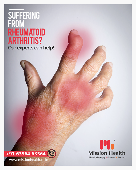 Rheumatoid Arthritis is a Chronic Inflammatory condition causing pain and deformities in peripheral joints like elbow,  wrist,  fingers,  knee and ankle. 

Known to be crippling condition, taking Physiotherapy sessions in early stage of disease can reduce pain and limit deformity of joints remarkably!  At Mission Health we treat patients with advanced non surgical pain technologies and exercise strategies to help prevent deformity and enhance function.

Don’t wait till your joints are deformed. Book your appointment now!

Call +916356263562
www.missionhealth.co.in

#rheumatic #rehab #arthritis #chronicpain #rheumatology #autoimmunedisease #autoimmune #pain #nonsurgicaltechnologies #rheumatoidarthritis #rheumaticdisease  #chronicillness #MissionHealth #MissionHealthIndia #MovementIsLife