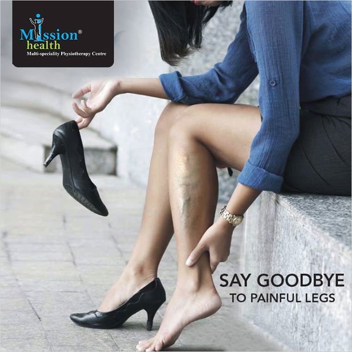 Varicose veins /Spider are quite common in females. 7 out of 10 females develop it during or after pregnancy. It develops due to poor functioning of vein valves. The Advanced physiotherapy program has shown promising results in treatment of varicose veins without any medications and surgery.  #MissionHealth #VaricoseVeins  #Indias1stNonSurgicalVeinClinic. For more details, call us at - 7622811811/8530720720 or visit us – www.missionhealth.co.in