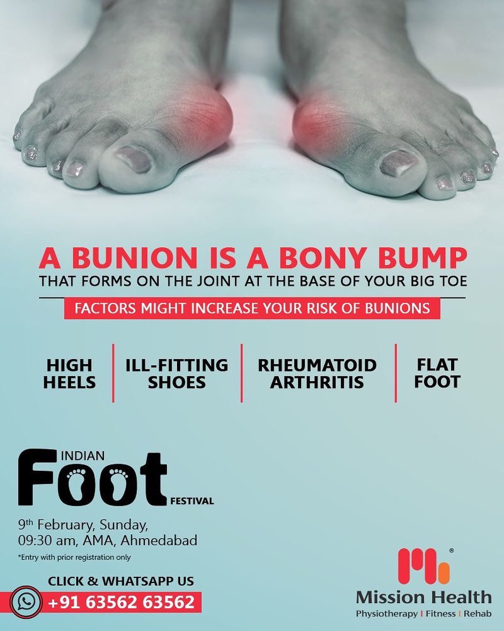 Wearing tight, narrow shoes might cause bunions or make them worse. Bunions can also develop as a result of the shape of your foot, a foot deformity or a medical condition, such as arthritis.

Call: +916356263562
Visit: www.missionhealth.co.in

#IndianFootFestival #ComingSoon #FootClinic #footpain #footcare #foothealth #heelpain #anklepain #flatfeet #painrelief #healthyfeet #happyfeet #MissionHealth #MissionHealthIndia #MovementIsLife