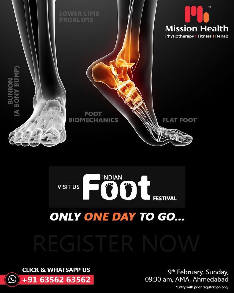 Flat FOOT l Foot Biomechanics l Lower Limb Problems l  Bunion (A Bony Bump) & other foot problems

Seats are booked for tomorrow's session. We wholeheartedly welcome all the registered participants for one of its kind experience ever... Only ONE Day to GO… 
Call: +916356263562
Visit: www.missionhealth.co.in

#IndianFootFestival #ComingSoon #FootClinic #footpain #footcare #foothealth #heelpain #anklepain #flatfeet #painrelief #healthyfeet #happyfeet #MissionHealth #MissionHealthIndia #MovementIsLife