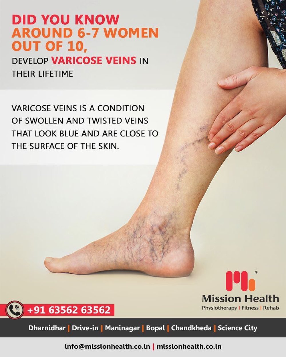 Mission Health offers a painless and non-surgical approach to treating Varicose Veins with -> Non-Surgical Pain & Circulation enhancing Technologies – A revolution in non-surgical management of Varicose Veins -> Varicose Veins Exercise Protocol -> Prevention Strategies & Lifestyle Modifications. 
This holistic Physiotherapy Programme has shown remarkable results in 90% cases of Varicose Veins, to the extent of healing the painful Venous Ulcers without medicines and surgery!

Call +916356263562
www.missionhealth.co.in

#varicoseveins #spiderveins #veintreatment #veins #spiderveintreatment #veinremoval #vascularphysiotherapy #varicoseveintreatment #veindoctor #varices #veinclinic #varicose #healthylegs #health #legveins #varicoseveins #MissionHealth #MissionHealthIndia #MovementIsLife