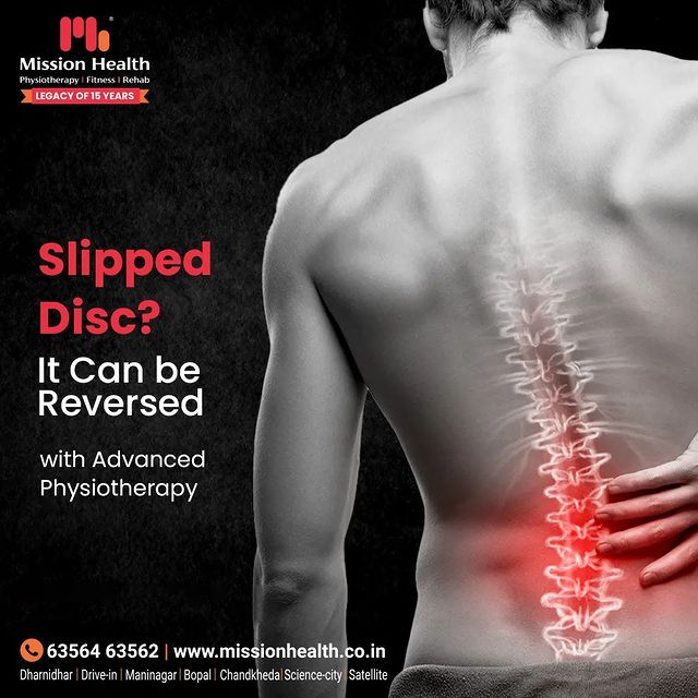 Slipped Disc? It can be reversed at 'Mission Health' with Advanced Physiotherapy by Spine Experts.

For more details, 📞 +91 63564 63562 or visit: www.missionhealth.co.in

#MissionHealth #MissionHealthIndia #MovementIsLife #ObesityClinic #DefeatObesity #LiveLight #Ahmedabad #Gujarat #SuperSpecialitySpineClinic #SpineClinic #BackPain #NeckPain #SlippedDisc #AbilityClinic