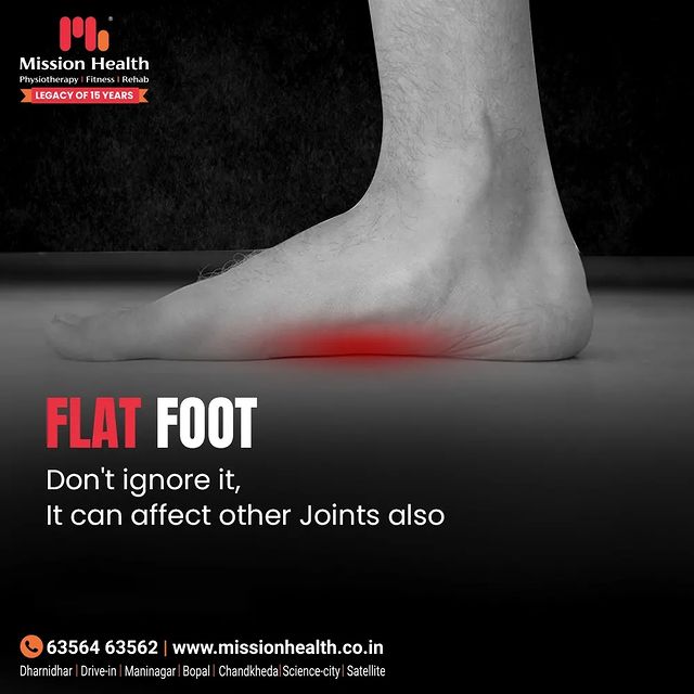 It is easy to cure a condition causing pain & difficulty in walking or doing extensive physical activity.

For more details, 📞 +91 63562 63562 or visit: www.missionhealth.co.in

#MissionHealth #MissionHealthIndia #MovementIsLife #Ahmedabad #Gujarat #flatfoot #health #fitness #fixflatfeet #flatfeetdeformity #curewithPhysiotherapy #Physiotherapy #healthylifestyle #fitnessmotivation
